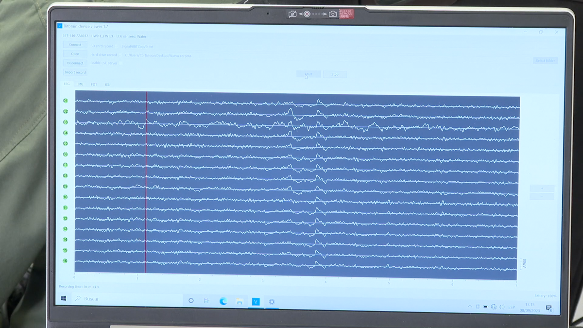 Neurotecnología 02
